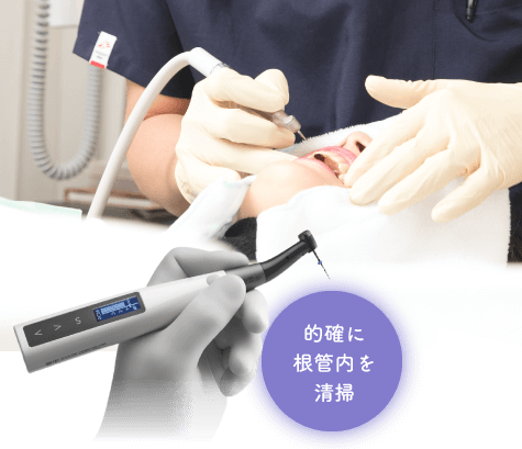 的確に根管内を清掃