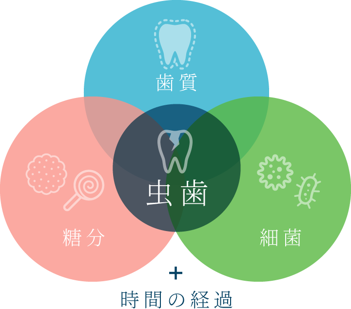 歯質+細菌+糖分+時間の経過=虫歯