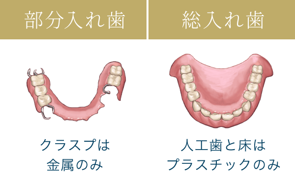 部分入れ歯…クラスプは金属のみ　総入れ歯…人工歯と床はプラスチックのみ